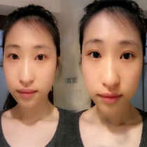 Invisible double eyelid patch light yellow 576 paste to send Y fork material invisible breathable Korean fog face