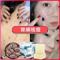 Sea salt mite soap mite removal artifact facial back handmade soap sulphur soap sterilization facial cleaning soap