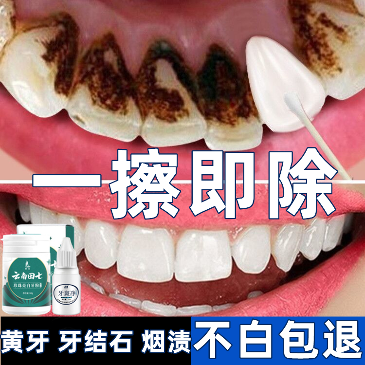歯磨き粉は、黄ばんだ歯を取り除き、歯を白くし、口臭を取り除き、即効性のある黄ばんだ歯を白くし、歯と汚れをきれいにし、歯石、煙の汚れ、歯石のアーチファクトを除去します。