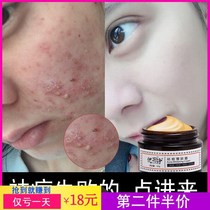Face head pimple ass azole sores acne ointment acne external use