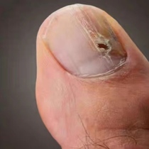 (Small Red Book Exploits) Bad A to turn a good A finger toe repair to change in a better Bundesliga without a bad Bundesliga buy two hair three