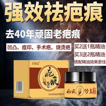 Self-drying scar care silicone gel (old scar Buster) Herb surgery scar hyperplasia repair cream bump