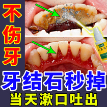 Special spray for dental calculus removal quick sterilization halitosis and tartar removal effect dissolving dental calculus artifact mouthwash