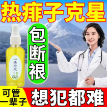 Hot prickly heat to remove prickly heat and relieve itching adult baby summer rash pimples to stop itching hot prickly heat water spray to remove prickly heat artifact