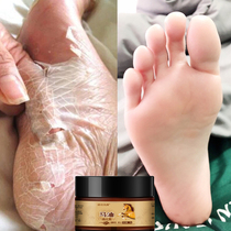 Chapped hands and feet dry rough peeling chapped cream Horse oil moisturizing cream winter hand and foot cream