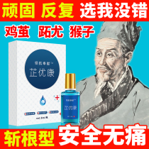 Zhi Youkang to corns foot Cocoon paste common especially meat Thorn monkey plantar foot monkey plantar wart cream calluses