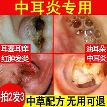 Special people use Zhongerkang purulent ear inflammation and pus special ointment chronic eardrum perforation swelling and pain can eradicate the King