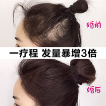 (Weiya recommended) The natural growth rate of hair is dense for men and women.
