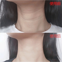 Neck black wash is not clean ~ fade neck pattern beauty white neck to melanin precipitation artifact also your swan neck