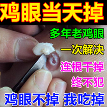 Chicken eye drops corns paste root spines feet toes fingers corns pain unbearable corns medicinal