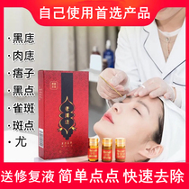 Beauty salon Household removal of face Chi spots black dots to children unisex without leaving marks