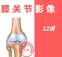 Knee Imaging Orthopedics Orthopedics video Nuclear magnetic CTX Line MRI Curriculum Radiotutorial Gauge