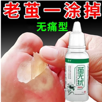 Chicken eye ointment softens the soles of the feet.