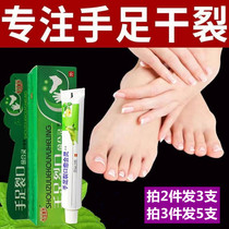 Chapped hands and feet Cracked heels Cracked moisturizing anti-crack Hand care Dry chapped hands and feet Repair Buy 2 get 1 free