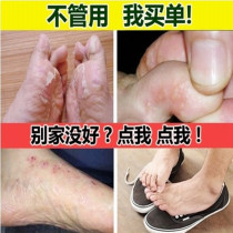 itchy feet itchy feet itchy toes crack itchy skin itchy feet blisters itchy feet blisters sterilization itchy feet itchy feet itchy feet itchy feet itchy feet itchy feet