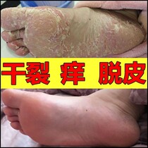 Dry Heel Repair Cream hands and feet seasonal peeling cracking cracking and chapping cream hand protection feet and dead skin
