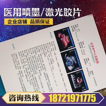 Medical PACS film) color Doppler ultrasound film MPET) Matt porcelain white) double-sided laser printing) 16K laser film