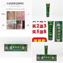 Du Miao nationality herbal ointment this fungus-suppressing cream skin topical ointment foot Moss skin wet itching hand cattle Moss