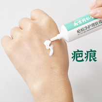 Nanjing Tongrentang herbal surgery scar hyperplasia repair ointment bump scar light melanin acne pit