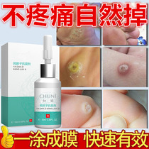  Remove plantar warts corns scorpions thorn monkey cream remove special artifact for the soles of the feet and hands flesh thorn warts