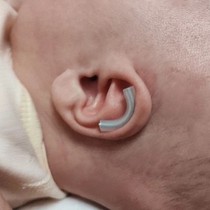  Newborn baby ear corrector Baby auricle traction correction deformity orthopedic wind-inducing ear lop shaping