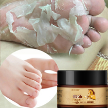 (Buy 1 get 1 free Buy 2 get 3 free) Foot steam buster~chapped moisturizing moisturizing foot cream a touch to restore the heel