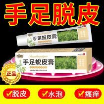 Hand and foot peeling antibacterial cream finger serious molting dry skin itchy blisters dry skin itchy blisters dry chapped