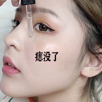 (Wei Ya recommended) The effect is too good to remove all black spots on the face no traces buy two get one free