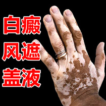 Vitiligo concealer artifact External face hand white spot skin color concealer Long-lasting waterproof concealer pen