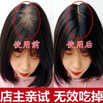 (I dont eat it) The natural growth rate of hair men and women hair speed becomes dense buy 3 get 2