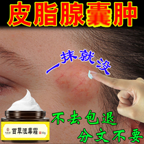 Sebaceous gland cyst cream acne vestibular gland elimination and extraction cream to remove parity tumor artifact subcutaneous cyst special drug