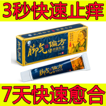Treatment of foot itching bacteriostatic foot eczema foot eczema foot eczema foot eczema anti-itching Deer God Li beriberi folk prescription antibacterial cream