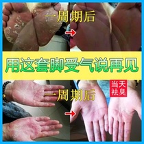 American Le hand foot fur official website original anti-dry crack hand and foot crack cream hand peeling set crack cream heel crack