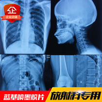 Medical film inkjet blue dry radiology print film dental fracture X-ray DR CT