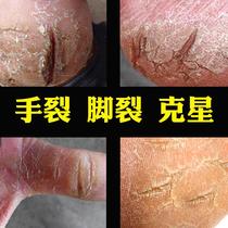 Horse oil cream anti-cracking cream Hand peeling dry peeling anti-cracking cream foot cracks hands and feet cracks oil healing and repair treatment