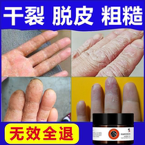 Hand peeling dry crack dry crack repair cream finger peeling rough crack anti-cracking cream hands and feet chapped skin