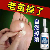  Chicken cocoon Kang foot cocoon calluses on the soles of the feet hand cocoon removal removal of cocoon cream special artifact dead skin softener hands and feet palm cocoon