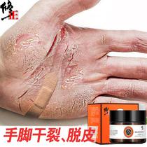 Cracked hands and feet Chapped hands and feet Cracked cracking repair Anti-crack hand cream Healing cream Finger peeling chapped dry horse oil