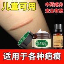 Scar cream repair cream scar magic repair cream surgery scald scar fall injury to acne mark a bottle of 35 grams