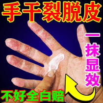 (New version can be broken root) hand and foot peeling ointment dry rough molting blisters itching hand and foot antibacterial ointment