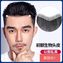  Real hair hairline m-shaped forehead hair replacement wig film mens hair loss biological wig paste fake bangs hair replacement block female