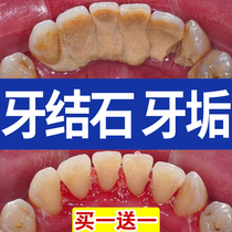Toothpaste to dissolve calculus quick-acting tartar removal artifact whitening yellow teeth Oral odor cleaning removal