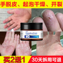 Hand peeling Seasonal childrens hand molting fingers palm cracking hands peeling dry peeling medicine repair cream