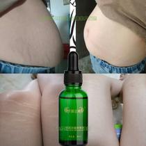 Postpartum stretch marks belly eliminate pregnancy pattern tightening pattern obesity pattern growth pattern thigh products