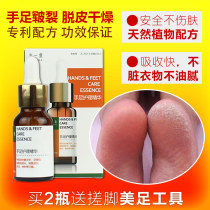 Zhongyitang hands feet cracked heels cracked heels cracked heels cracked heels cracked heels cracked cream peeling anti-cracking cream