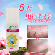 Chapped hands feet feet peeling care spray cracked heels mouth cream exfoliation keratin moisturizing moisturizing tender feet