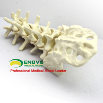 Orthopedic preoperative Sawbone Human lumbar spine model Artificial bone model Orthopedic surgery simulation bone demonstration
