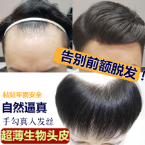 Hot sale Biological scalp bionic film M-type covers small scars Reduce hairline Real hair forehead hair patch
