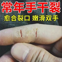 Renhe finger crack dry crack hand and foot chapped repair hand cream anti-crack cream hand and foot peeling opening healing