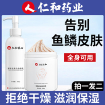 Fish scale skin cream to remove the calf whole body skin dry peeling skin disease dander goose bumps moisturizing body milk